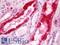 Zinc Fingers And Homeoboxes 2 antibody, LS-B11377, Lifespan Biosciences, Immunohistochemistry paraffin image 