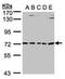 5'-Aminolevulinate Synthase 2 antibody, NBP1-32826, Novus Biologicals, Western Blot image 