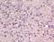 ETS Variant 1 antibody, orb156767, Biorbyt, Immunohistochemistry paraffin image 