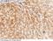 Carboxypeptidase B2 antibody, 11504-RP02, Sino Biological, Immunohistochemistry paraffin image 