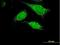 Pyrophosphatase (Inorganic) 2 antibody, H00027068-B01P, Novus Biologicals, Immunocytochemistry image 