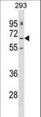 Gamma-Aminobutyric Acid Type A Receptor Epsilon Subunit antibody, LS-C166329, Lifespan Biosciences, Western Blot image 