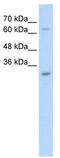 NSE1 Homolog, SMC5-SMC6 Complex Component antibody, TA330504, Origene, Western Blot image 