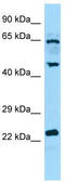 Dual Specificity Phosphatase 14 antibody, TA338118, Origene, Western Blot image 