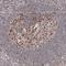 Interacts With SUPT6H, CTD Assembly Factor 1 antibody, HPA035719, Atlas Antibodies, Immunohistochemistry paraffin image 