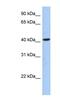 OTU Deubiquitinase With Linear Linkage Specificity Like antibody, NBP1-59979, Novus Biologicals, Western Blot image 