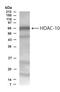 Histone Deacetylase 10 antibody, TA336886, Origene, Western Blot image 