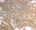 Solute Carrier Family 1 Member 4 antibody, A3084, ABclonal Technology, Immunohistochemistry paraffin image 