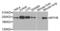 Myosin Heavy Chain 9 antibody, LS-C330816, Lifespan Biosciences, Western Blot image 