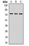 Zinc Finger Protein 264 antibody, LS-C668497, Lifespan Biosciences, Western Blot image 