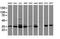Cytochrome P450 Family 2 Subfamily A Member 6 antibody, NBP2-01437, Novus Biologicals, Western Blot image 
