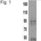 Actinin Alpha 4 antibody, MA1-800, Invitrogen Antibodies, Western Blot image 