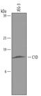 C1D Nuclear Receptor Corepressor antibody, AF4816, R&D Systems, Western Blot image 