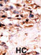 Uridine-Cytidine Kinase 1 Like 1 antibody, abx033219, Abbexa, Immunohistochemistry paraffin image 