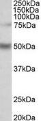 Unc-51 Like Kinase 3 antibody, TA309536, Origene, Western Blot image 