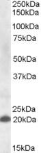 C-Type Lectin Domain Family 4 Member C antibody, EB09343, Everest Biotech, Western Blot image 