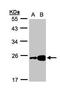 Fatty Acid Binding Protein 6 antibody, GTX105556, GeneTex, Western Blot image 