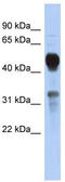 Mevalonate Kinase antibody, TA335151, Origene, Western Blot image 