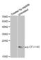 Cofilin 1 antibody, abx000230, Abbexa, Western Blot image 