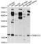 Thioredoxin Domain Containing 12 antibody, A14403, ABclonal Technology, Western Blot image 