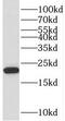 Transmembrane Protein 199 antibody, FNab08768, FineTest, Western Blot image 