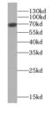 Hyaluronan mediated motility receptor antibody, FNab03936, FineTest, Western Blot image 