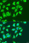 Methylcrotonoyl-CoA Carboxylase 2 antibody, A15181, ABclonal Technology, Western Blot image 