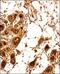 Estrogen Receptor 2 antibody, NBP2-81132, Novus Biologicals, Immunohistochemistry paraffin image 