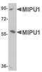 Zinc Finger Protein 667 antibody, PA5-20769, Invitrogen Antibodies, Western Blot image 
