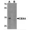 Chromobox 4 antibody, MBS150226, MyBioSource, Western Blot image 