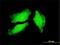 Peptidyl Arginine Deiminase 4 antibody, H00023569-M01, Novus Biologicals, Immunocytochemistry image 