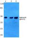 EPH Receptor B1 antibody, PA5-36802, Invitrogen Antibodies, Western Blot image 