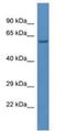 Leucine Aminopeptidase 3 antibody, NBP1-79642, Novus Biologicals, Western Blot image 