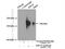 Kinesin-like protein KIF14 antibody, 26000-1-AP, Proteintech Group, Immunoprecipitation image 