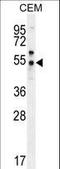 Folate Hydrolase 1B antibody, LS-C162225, Lifespan Biosciences, Western Blot image 