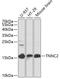 Troponin C2, Fast Skeletal Type antibody, 23-146, ProSci, Western Blot image 