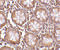 CD248 Molecule antibody, 4359, ProSci, Immunohistochemistry frozen image 