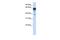 Kirre Like Nephrin Family Adhesion Molecule 1 antibody, GTX46299, GeneTex, Western Blot image 