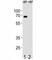 ETS Variant 5 antibody, F40893-0.4ML, NSJ Bioreagents, Flow Cytometry image 