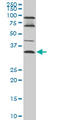 Epithelial Stromal Interaction 1 antibody, LS-B4543, Lifespan Biosciences, Western Blot image 