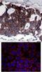 ERBB2 antibody, 79-309, ProSci, Immunohistochemistry paraffin image 