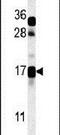 CSAG Family Member 3 antibody, PA5-25339, Invitrogen Antibodies, Western Blot image 