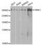 WNK1 antibody, abx002006, Abbexa, Western Blot image 