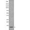 Dresden prostate carcinoma protein 2 antibody, PA5-64520, Invitrogen Antibodies, Western Blot image 