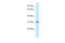 Mitochondrial Ribosomal Protein L19 antibody, A09595, Boster Biological Technology, Western Blot image 