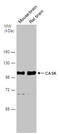 Calcium/Calmodulin Dependent Serine Protein Kinase antibody, GTX133275, GeneTex, Western Blot image 