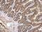 Protein Kinase D2 antibody, GTX102212, GeneTex, Immunohistochemistry paraffin image 