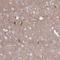 NUMB Like Endocytic Adaptor Protein antibody, NBP2-34104, Novus Biologicals, Immunohistochemistry paraffin image 