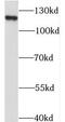 StAR Related Lipid Transfer Domain Containing 8 antibody, FNab08293, FineTest, Western Blot image 