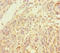 Inositol Polyphosphate-4-Phosphatase Type II B antibody, LS-C678353, Lifespan Biosciences, Immunohistochemistry paraffin image 